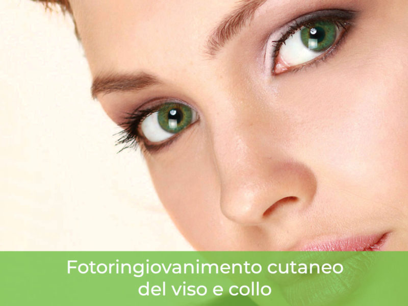 Fotoringiovanimento cutaneo Monza Brianza