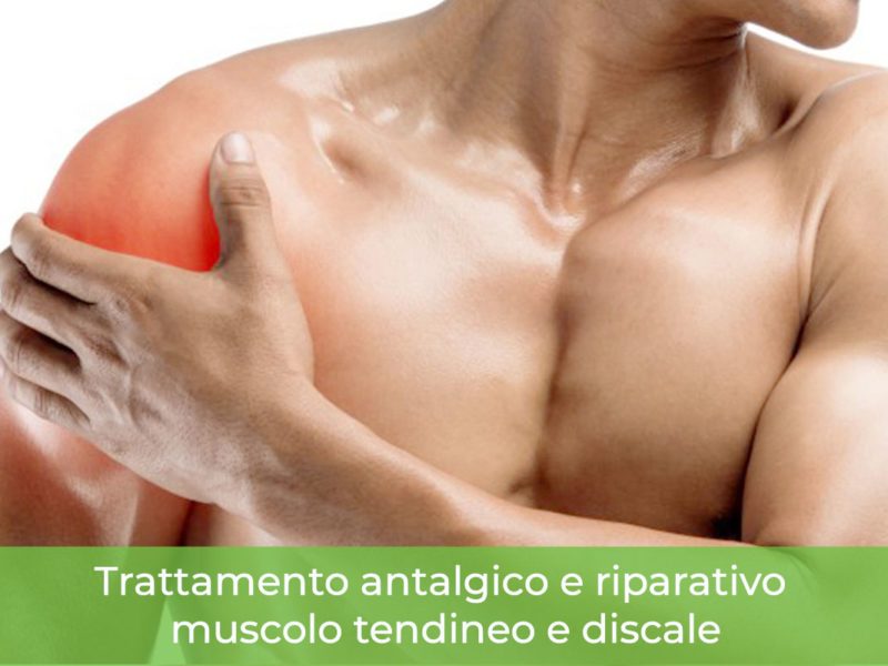 Trattamento antalgico e riparativo muscolo tendineo Monza Brianza