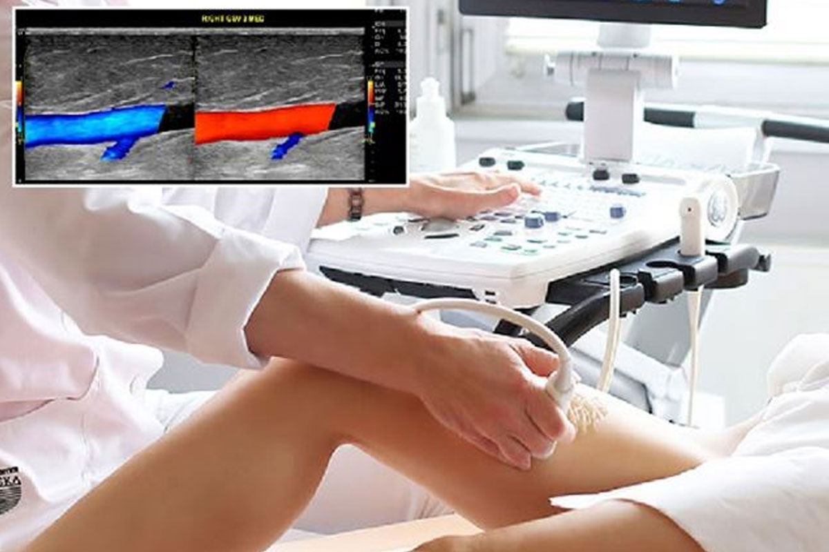 Ecocolordoppler Monza Brianza