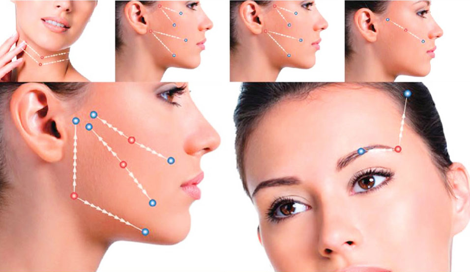 Fili di sospensione Monza Brianza Fili di sospensione Monza Brianza