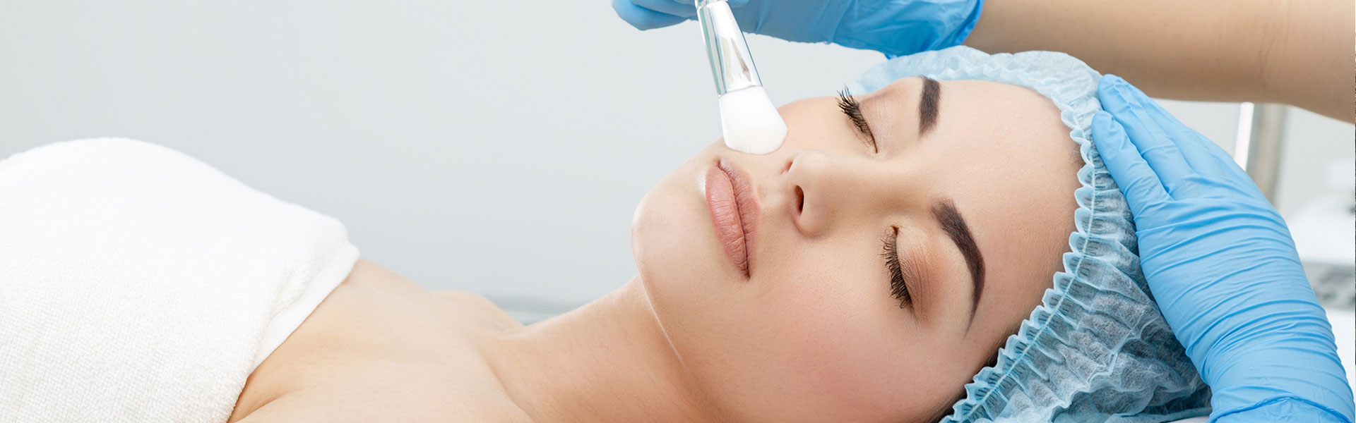 Peeling chimico Monza Brianza