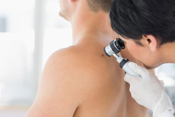 Visita prevenzione melanoma Monza Brianza-03