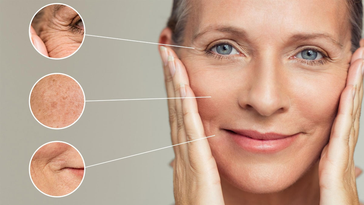 Anti aging - ridurre rughe e segni del tempo